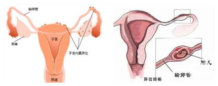 捐卵者条件
