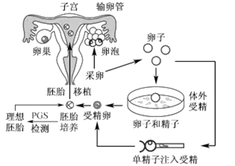 捐卵试管价格