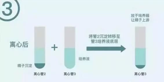 捐卵试管婴儿