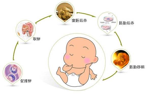 捐卵试管婴儿