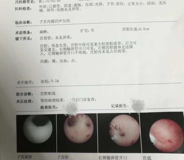 试管婴儿