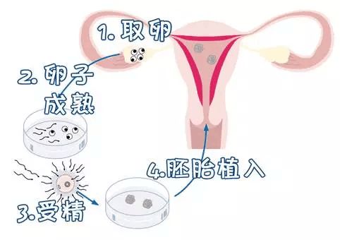 卵子