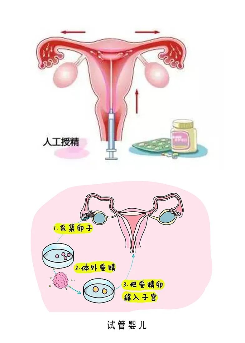 肇庆试管代怀孕公司