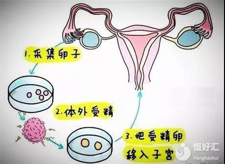 卵子